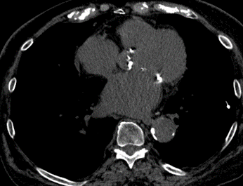 chest imaging